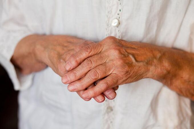 Schmerzen in den Gelenken der Hände stören oft ältere Menschen. 