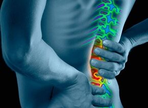Ursachen und Symptome einer Osteochondrose