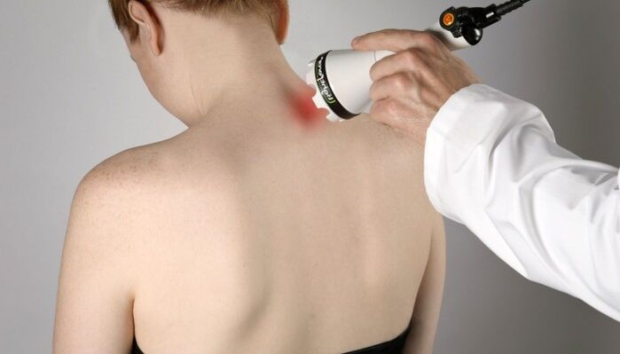 Lasertherapie bei zervikaler Osteochondrose.