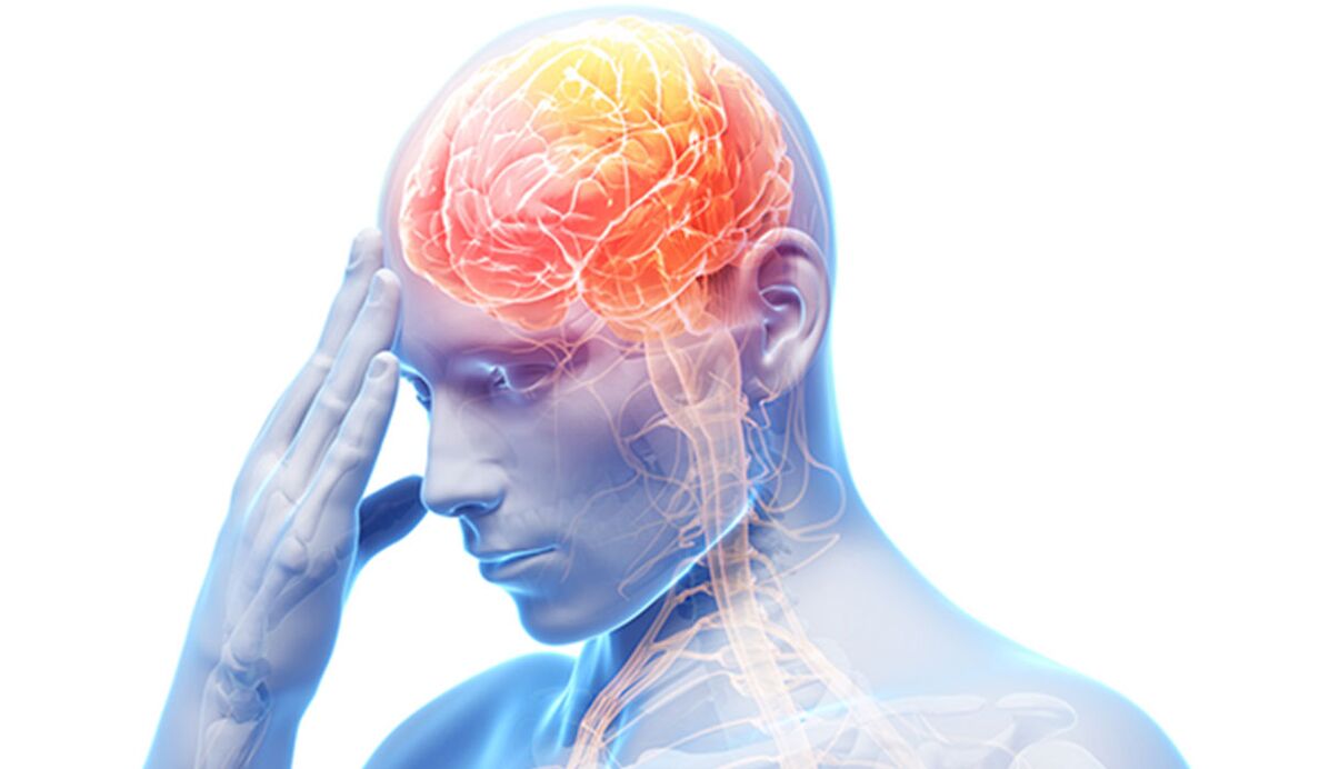 Tumor im Kopf als Ursache für Kreuzschmerzen.